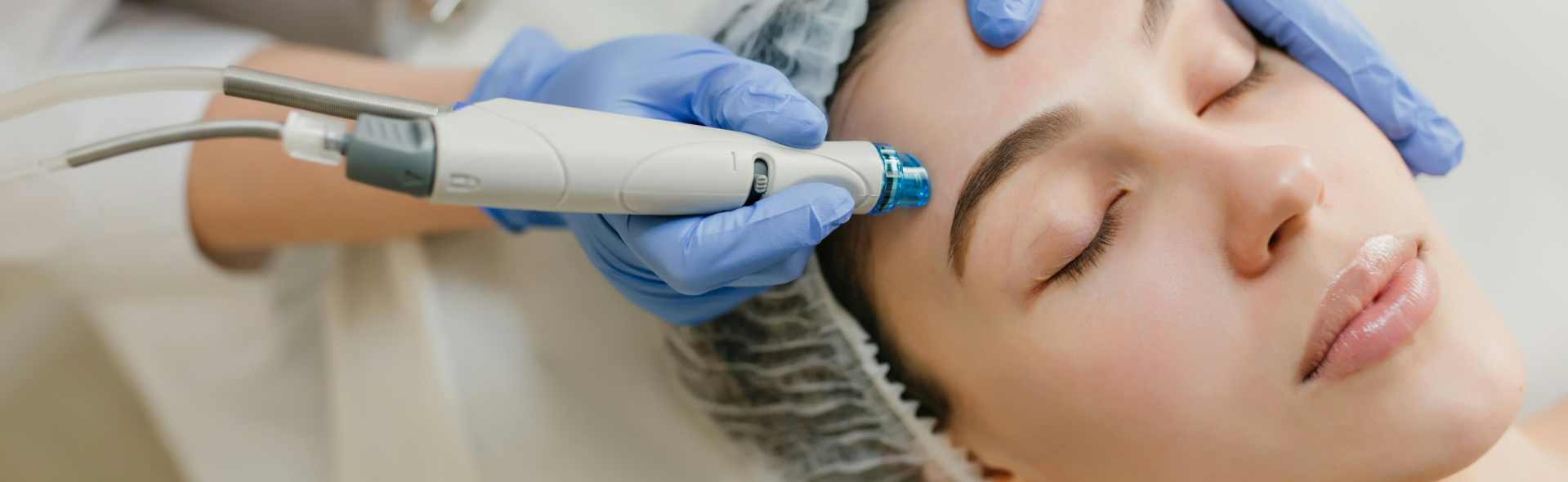 Laser skin treatment results at SLMC LaserPlus Ottawa clinic